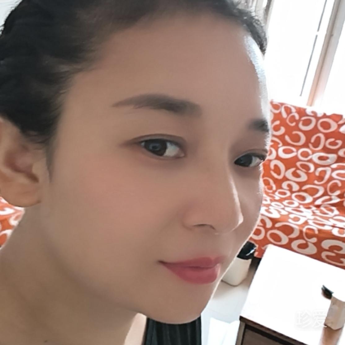 后来太美