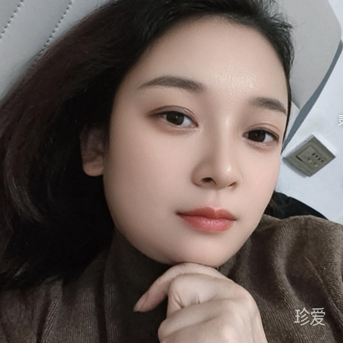 后来太美