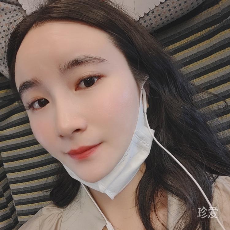 xlin