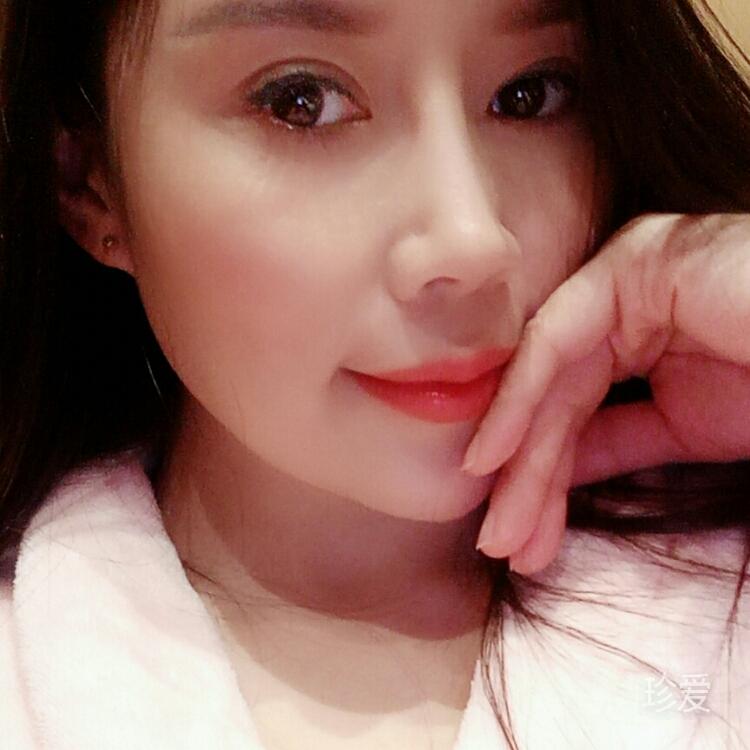 阿梅