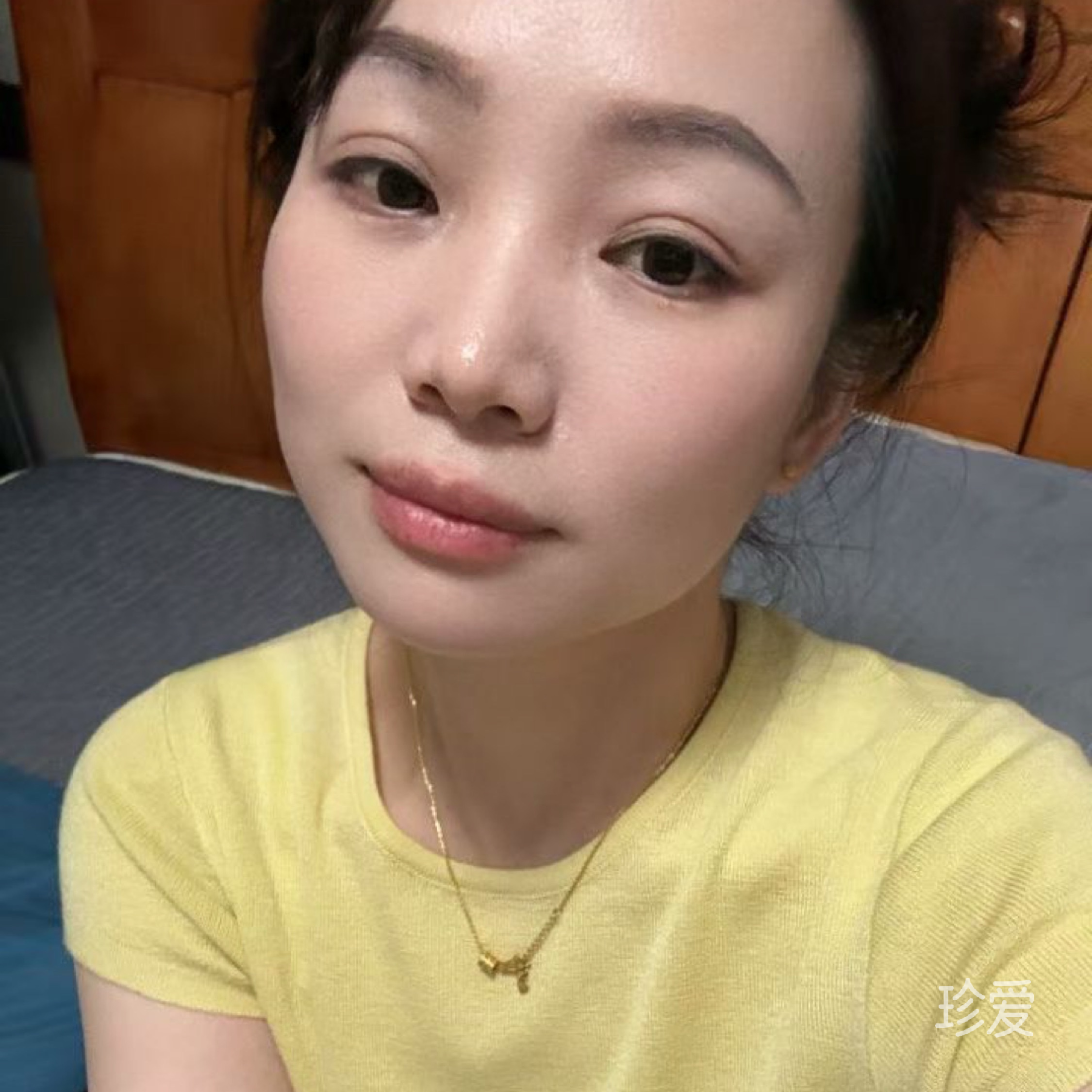花蕾
