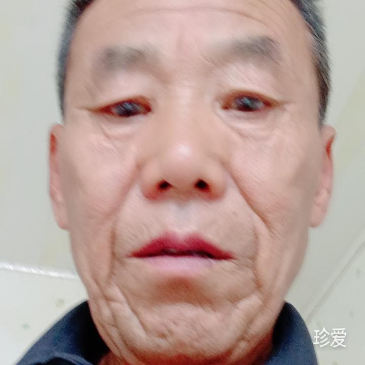 做你的影子