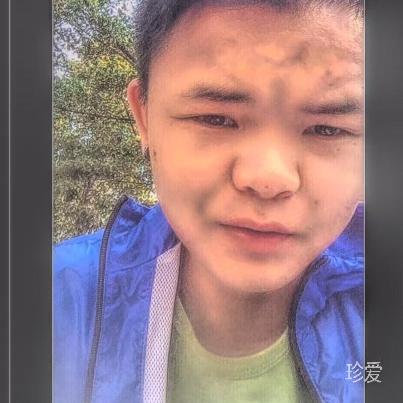 阿琪