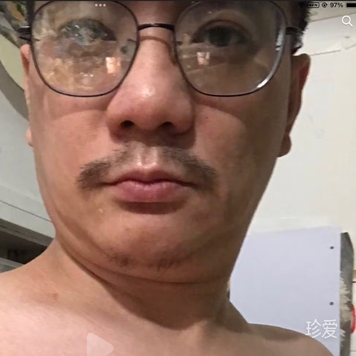 阿明