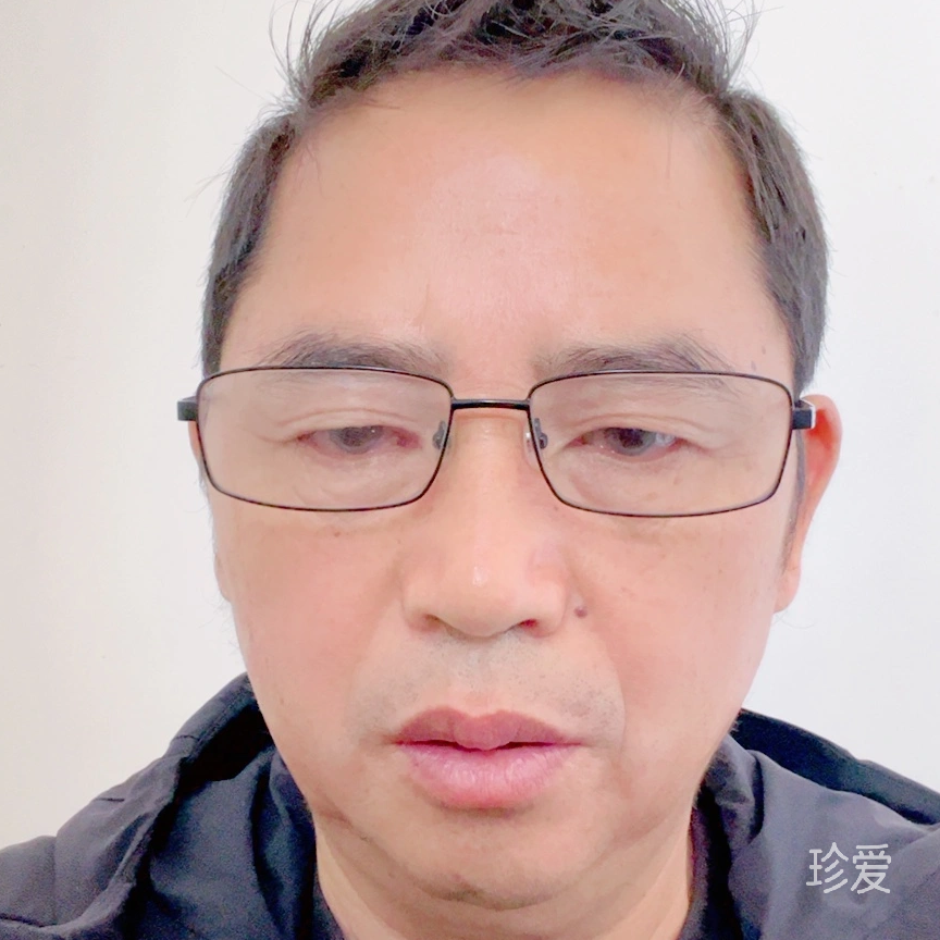 我遷就你的任性