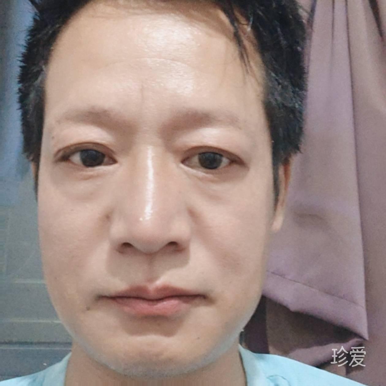 些戈