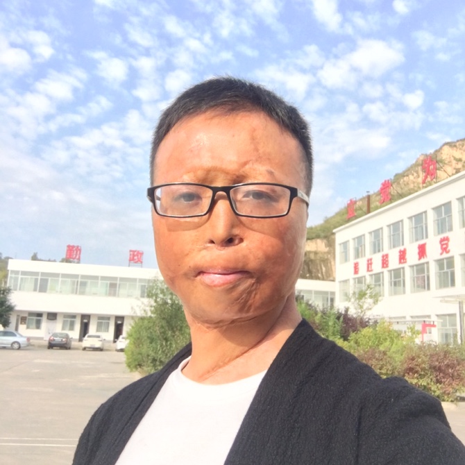 春天的陽(yáng)光