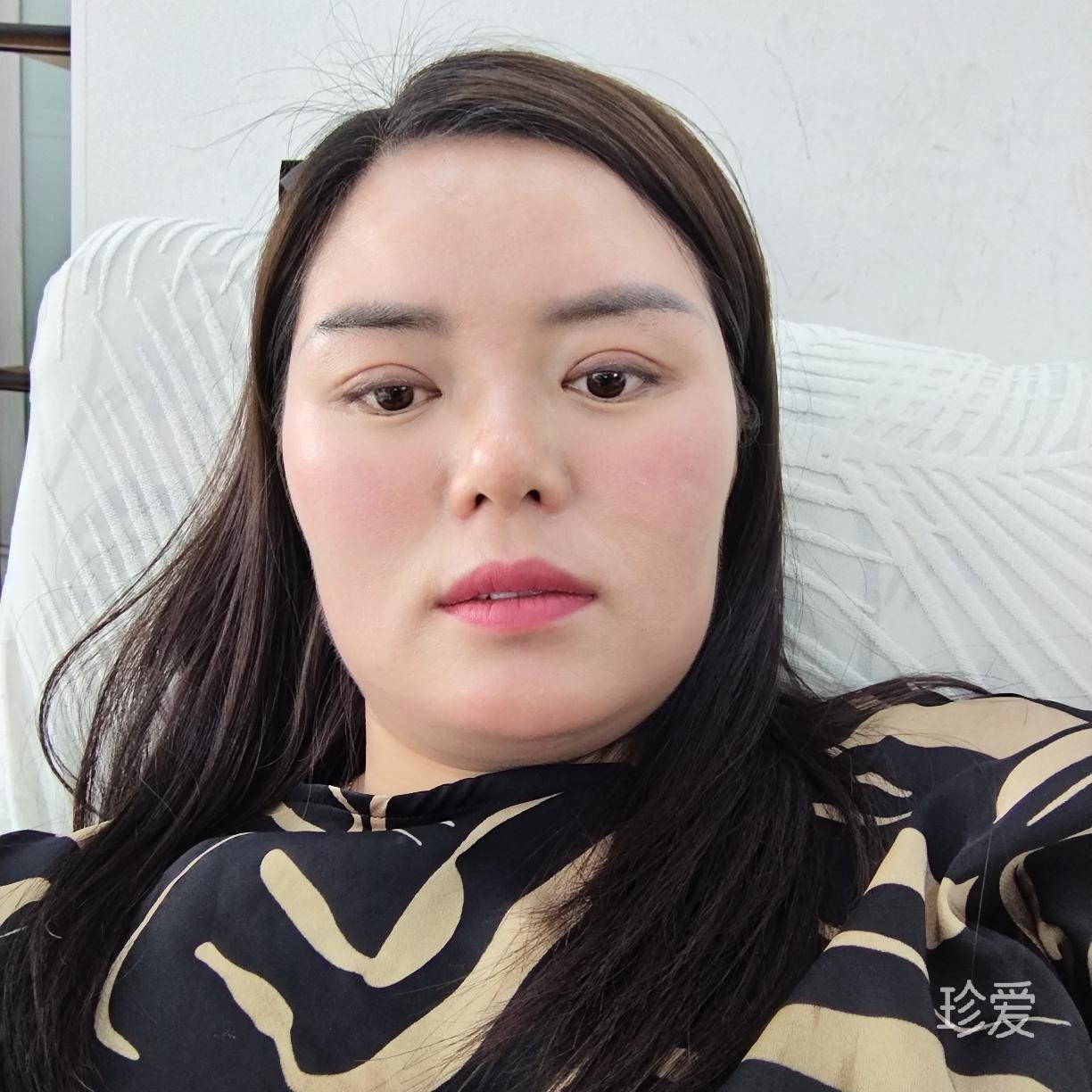 昭通大院村庙坝白