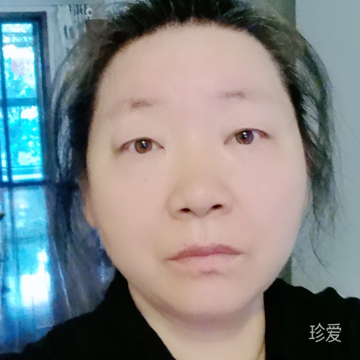 雪之湖