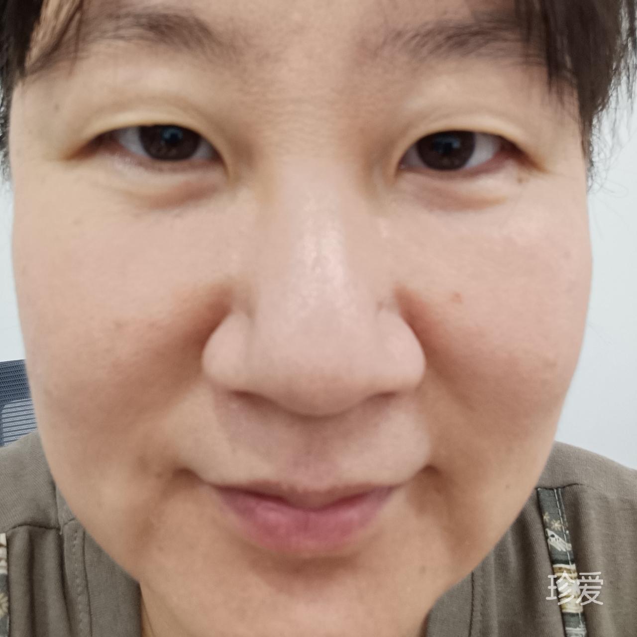 大鼻子