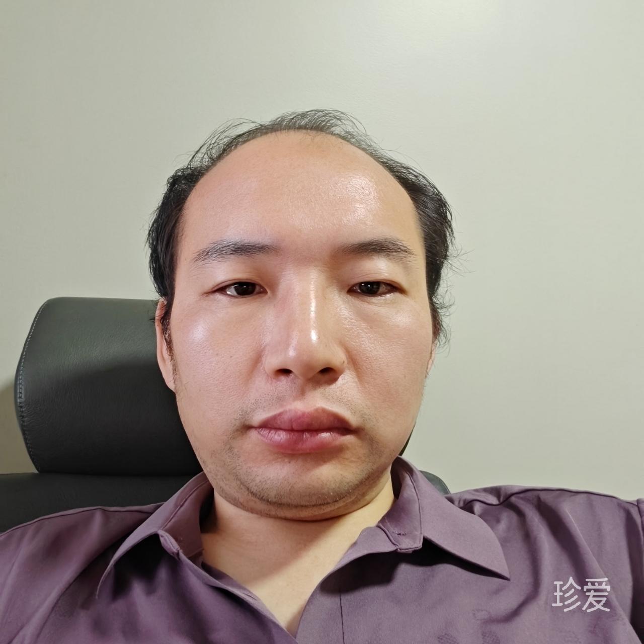 狐影