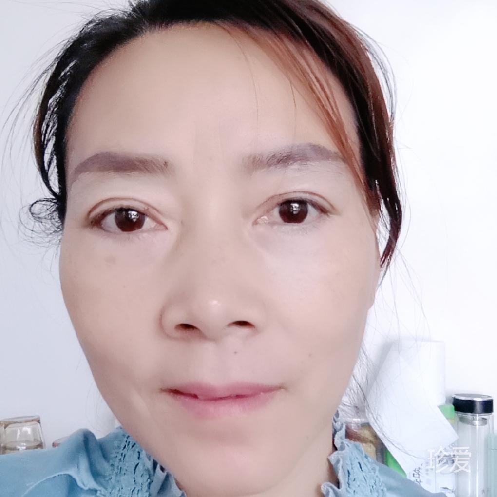 苏雅