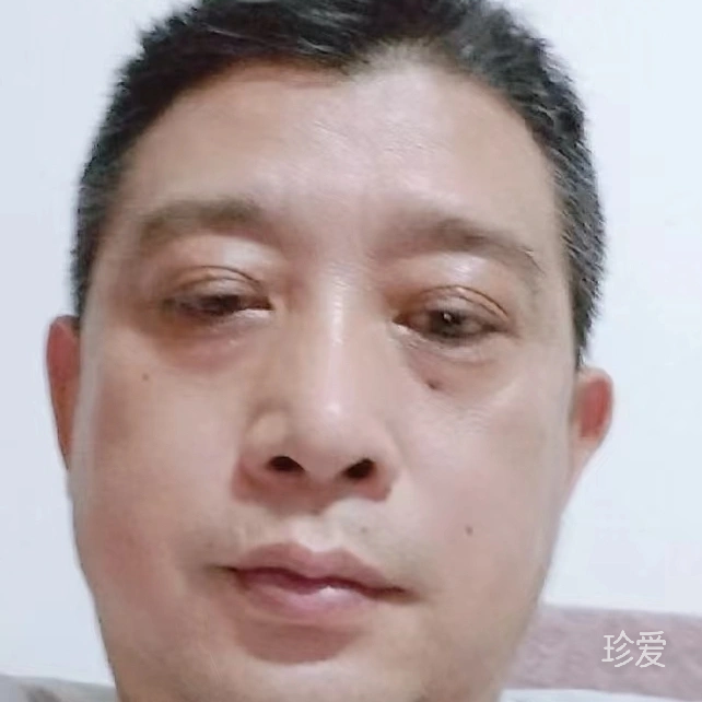 宽容