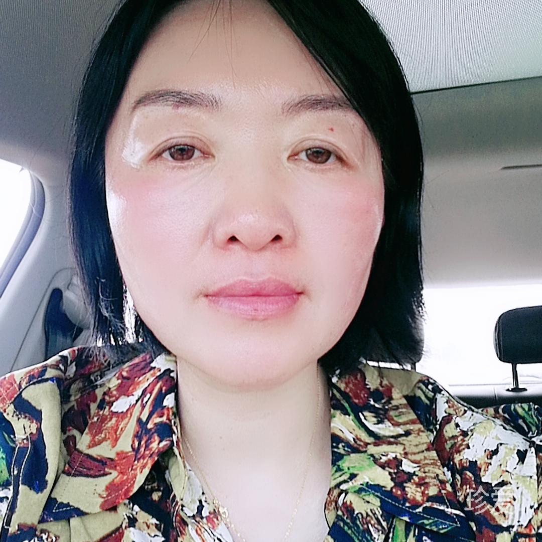 活泼的爱