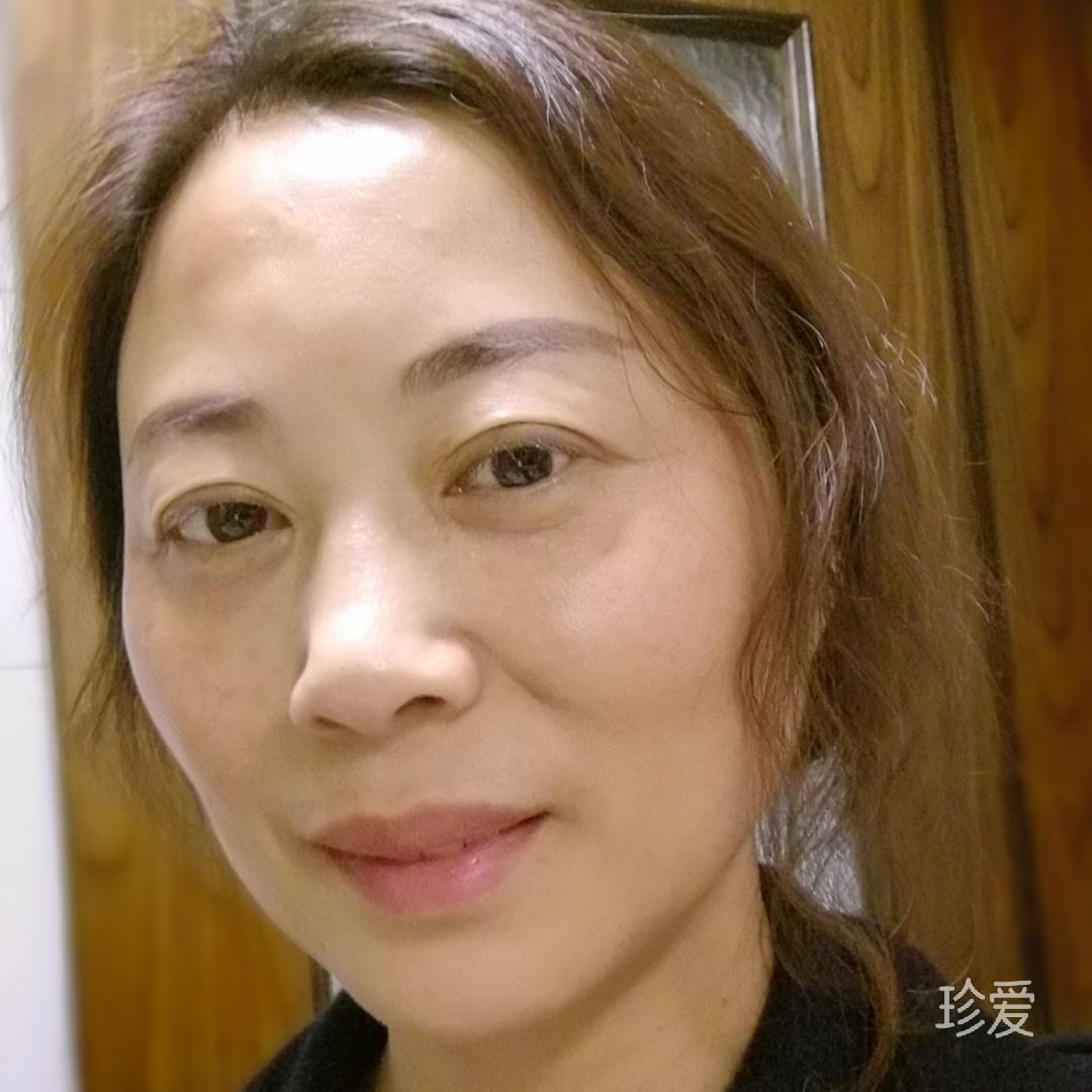 玲珑