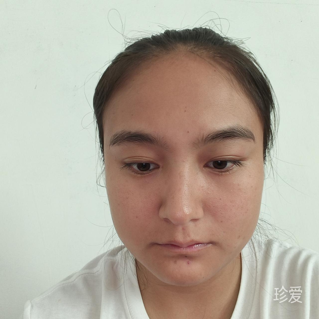 小心地皮