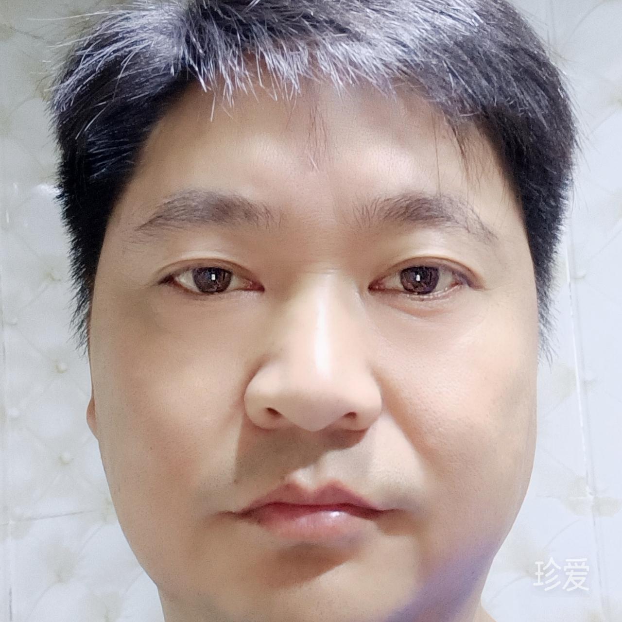 小金