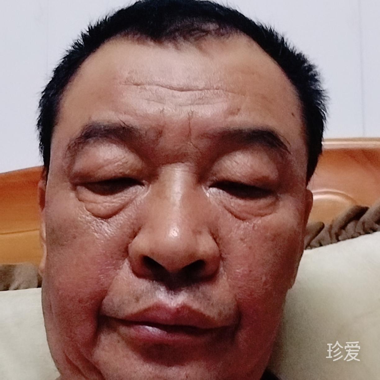 臨窗觀雨