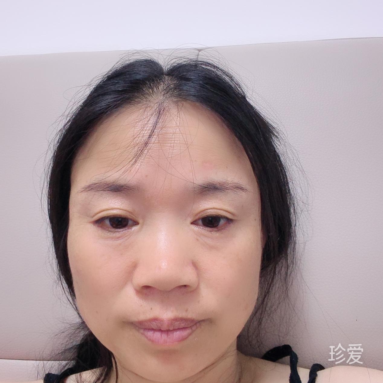 宝儿