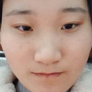 我先来看看情况