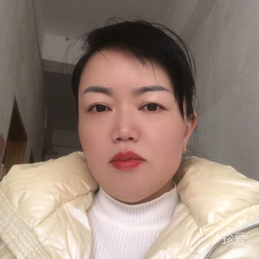 百合