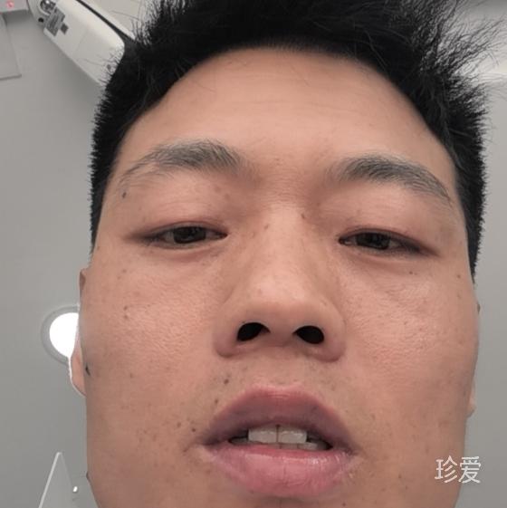 守护
