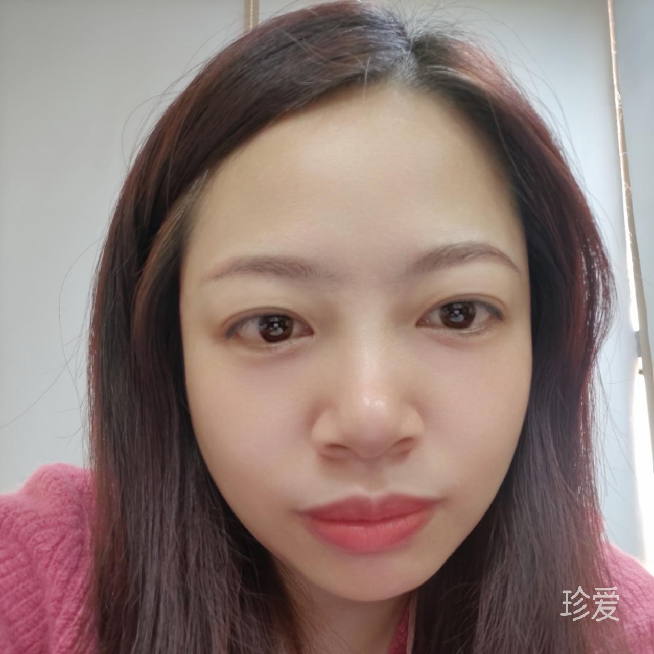 Sunny_