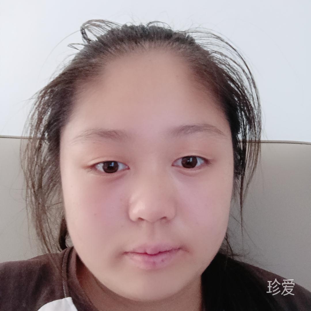 樱桃小兔子