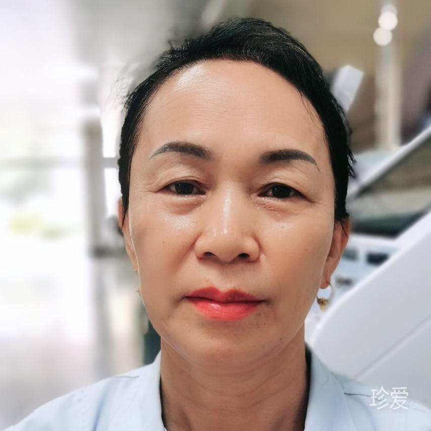 阿健