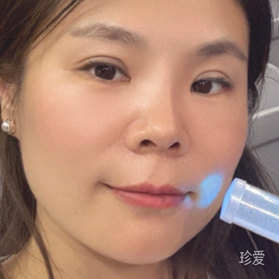 美丽