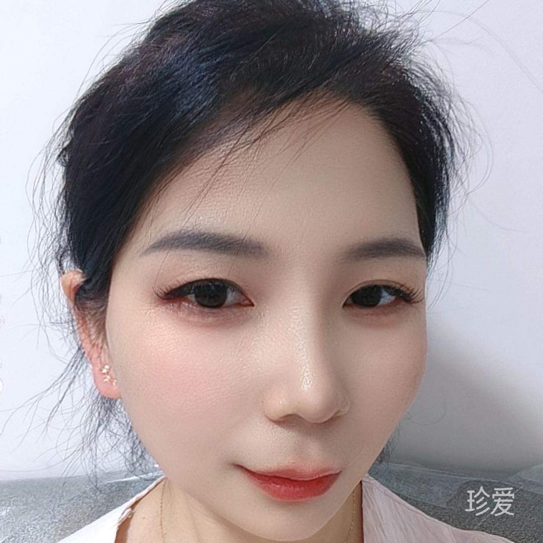 小非
