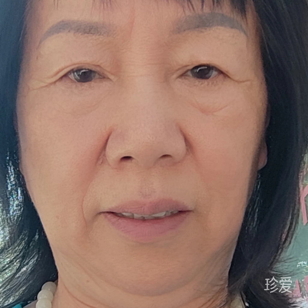 失去泪痕