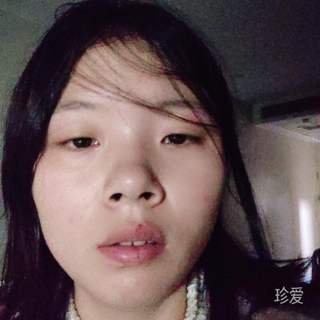 李绍玲
