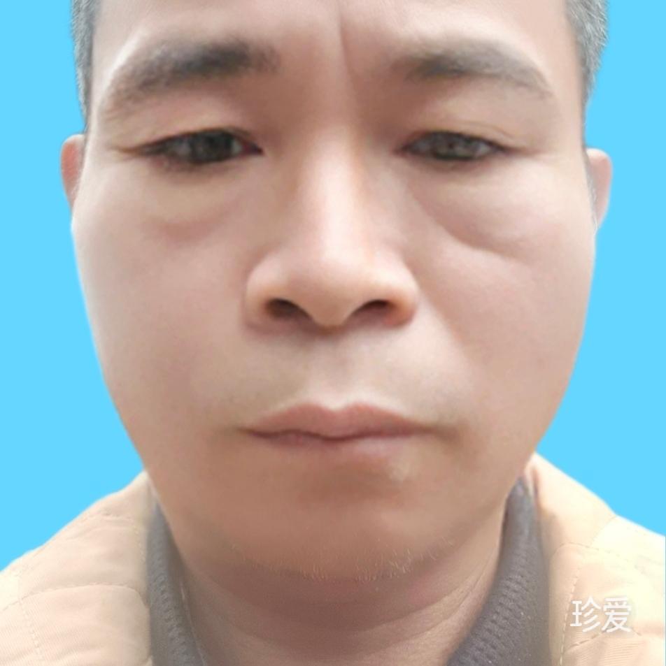 梁子