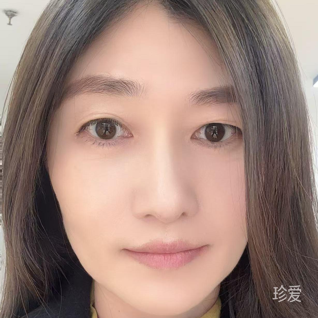 黎明