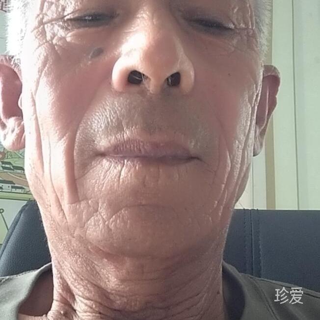 爱善爱