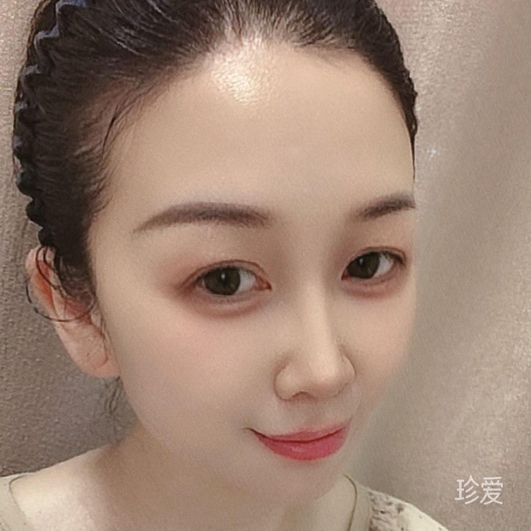 琪琪
