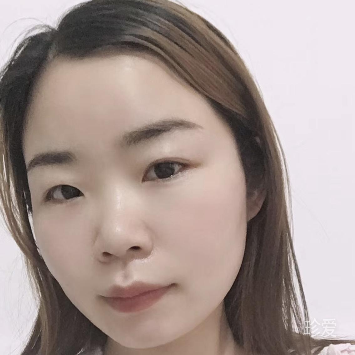 小太阳