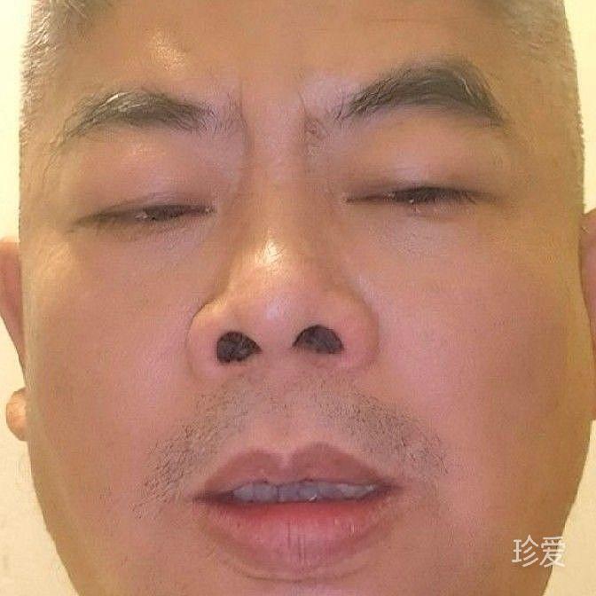 路过蜻蜓