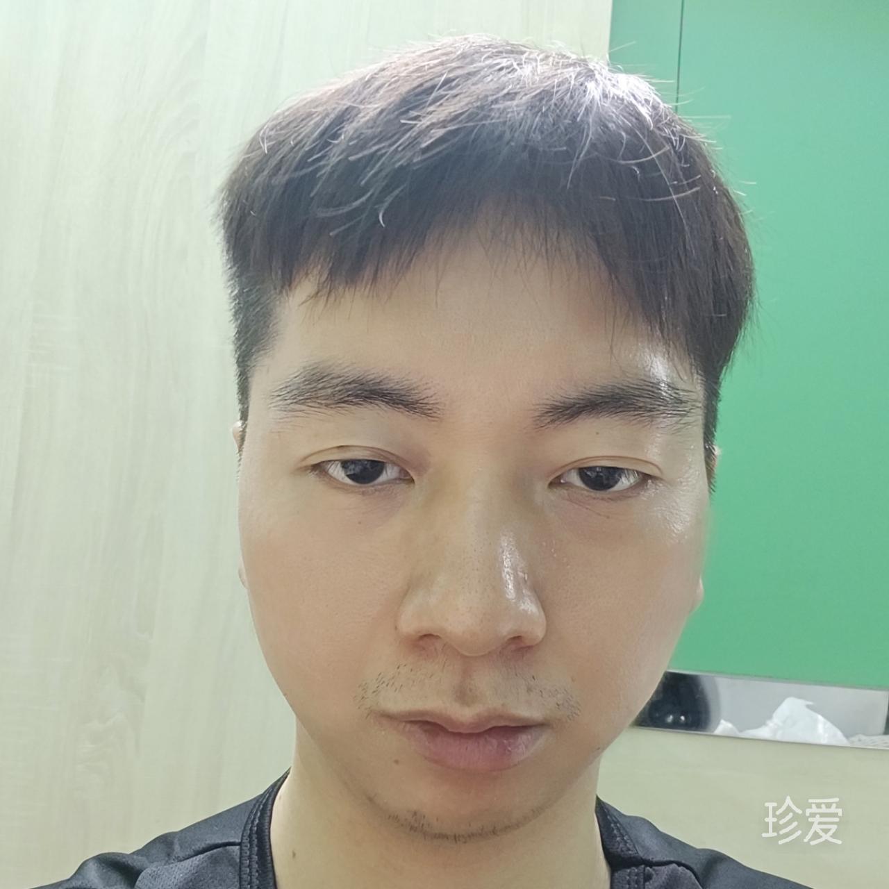 陈义