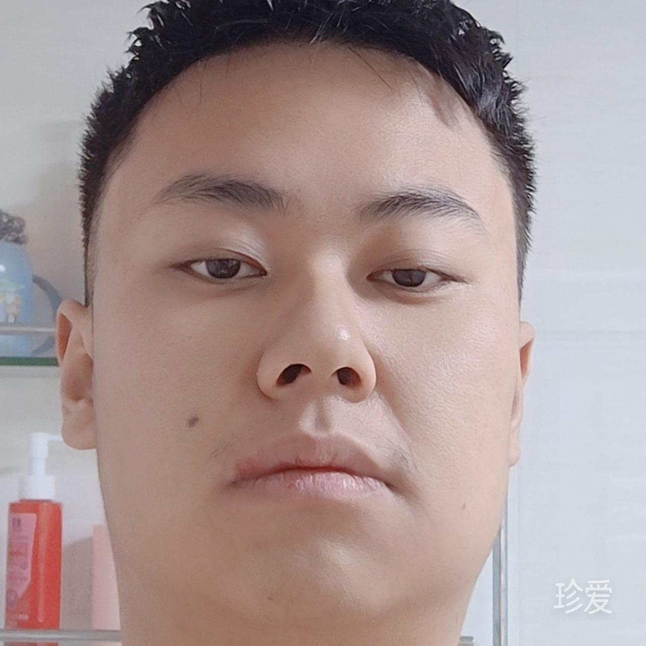 昨天即将重来