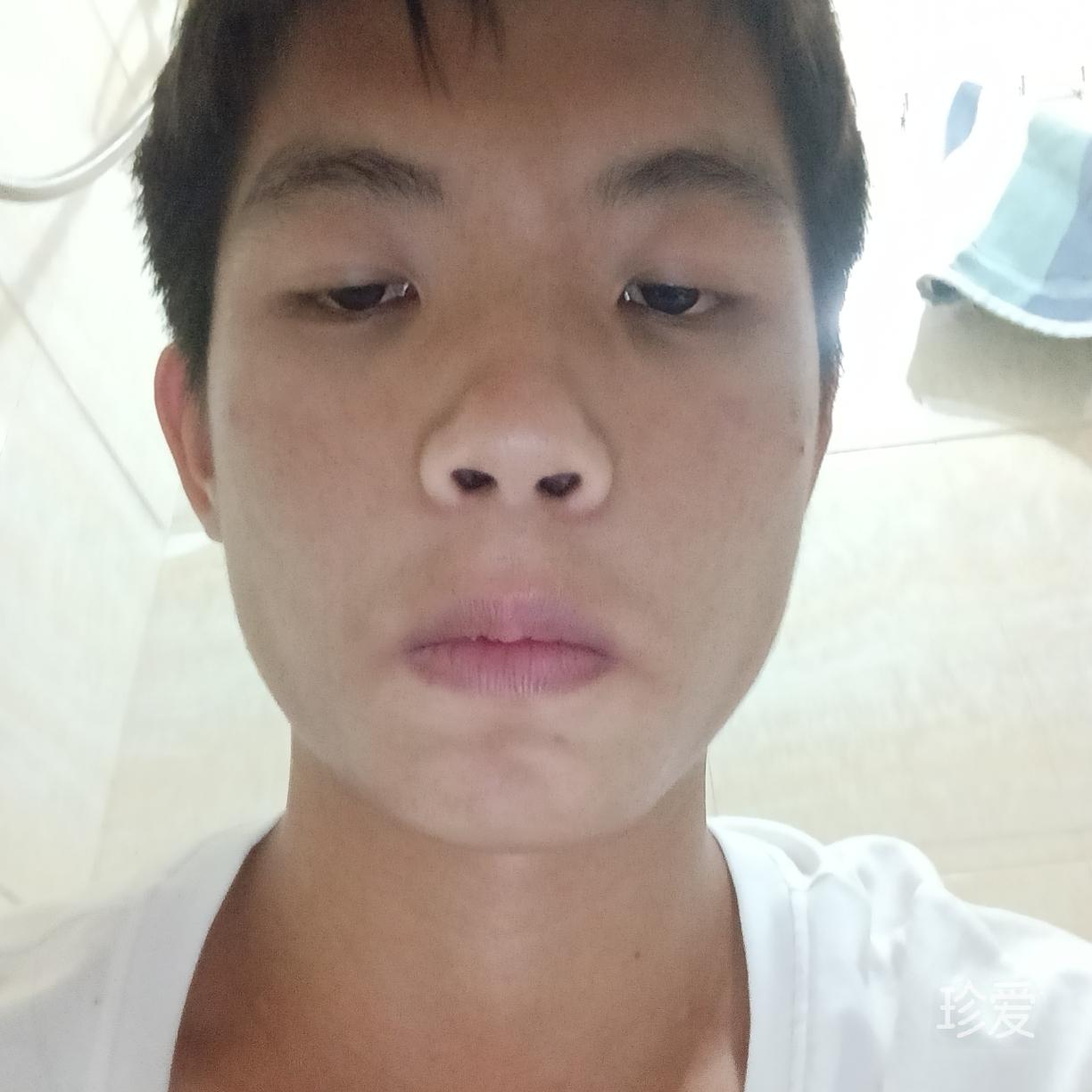 高冷病友