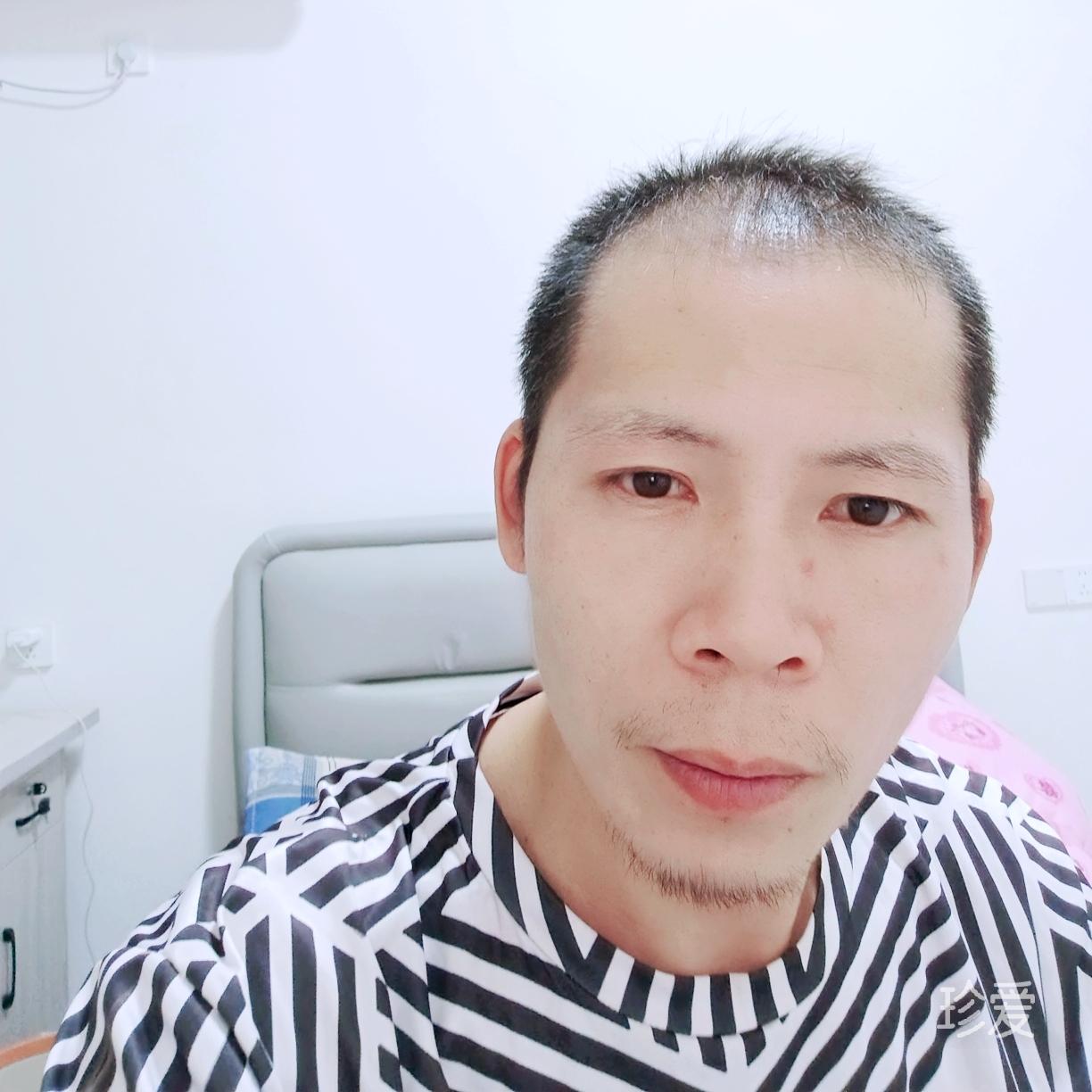 阿元
