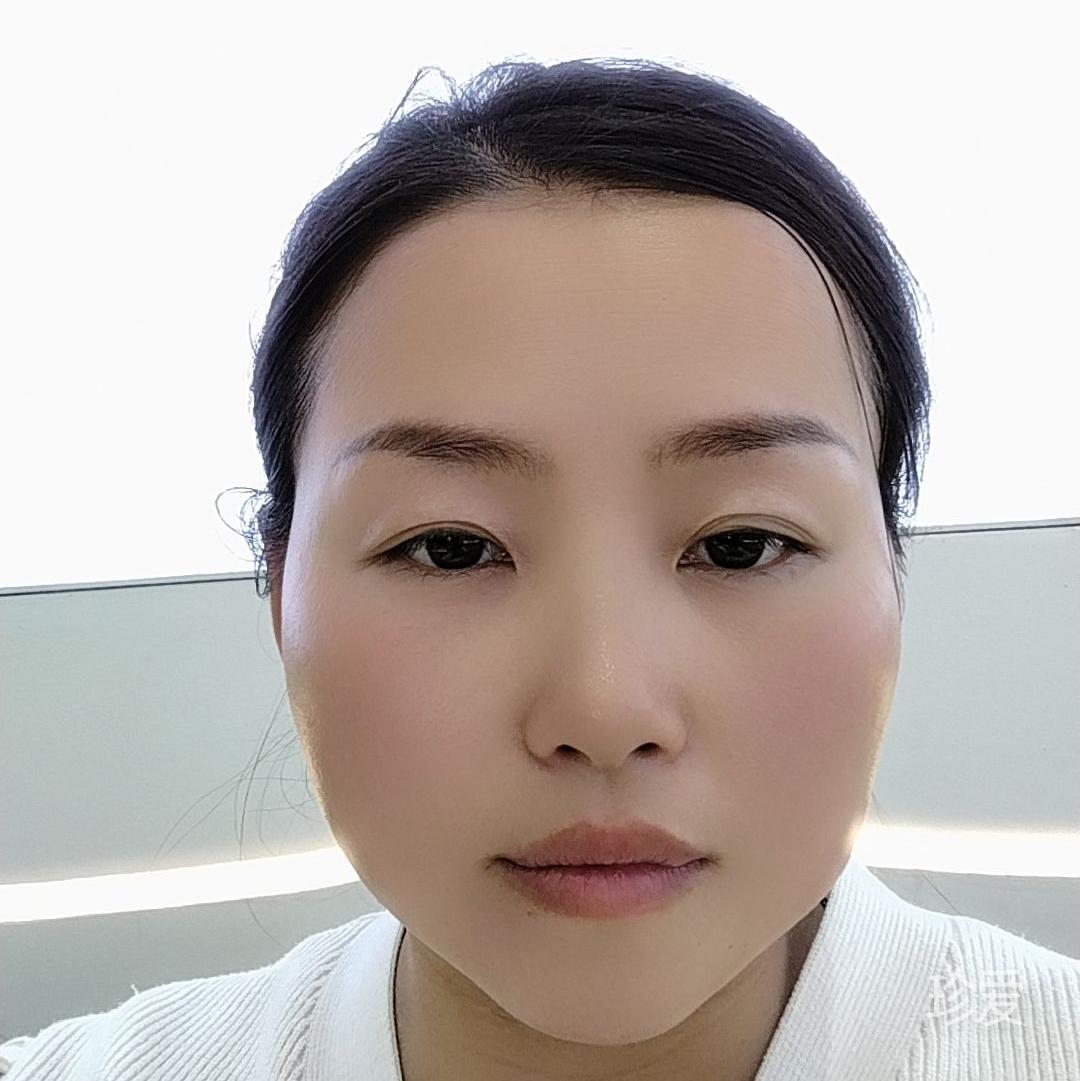 昕昕