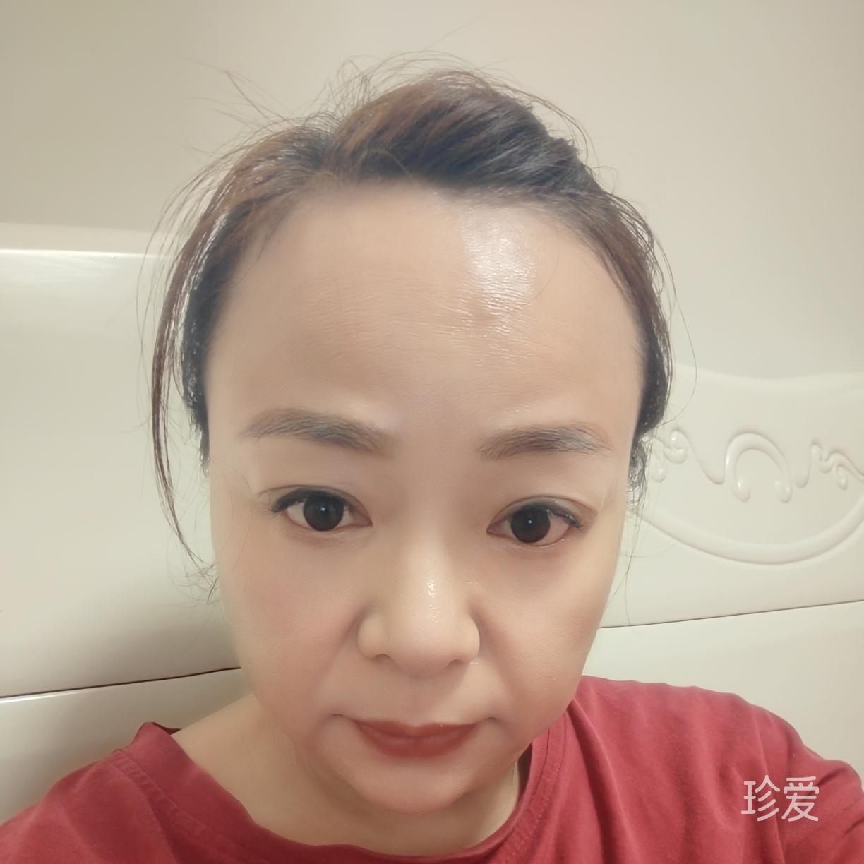 单细胞