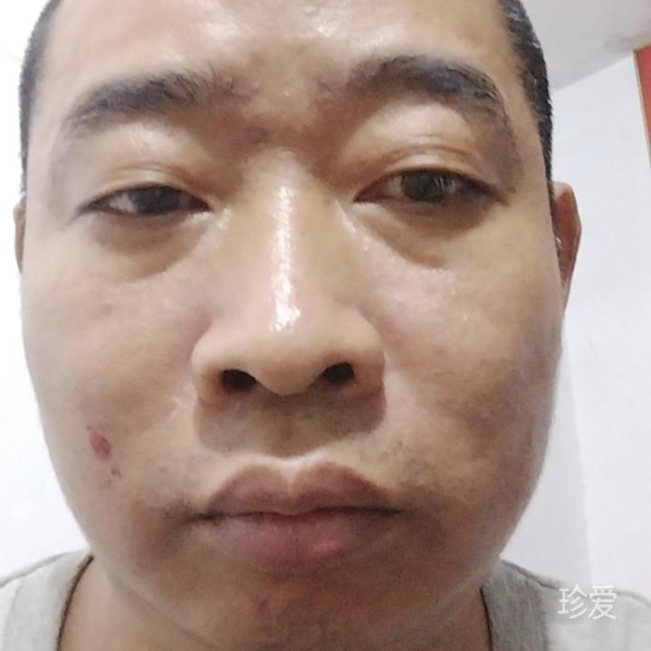 等春天花开