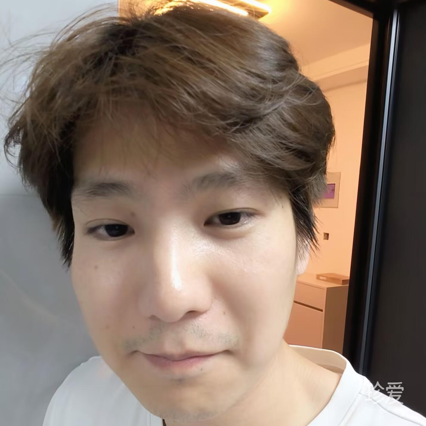 过期少年
