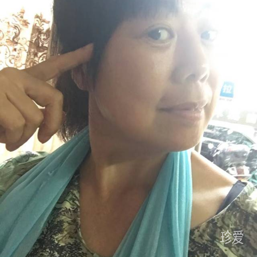 小米