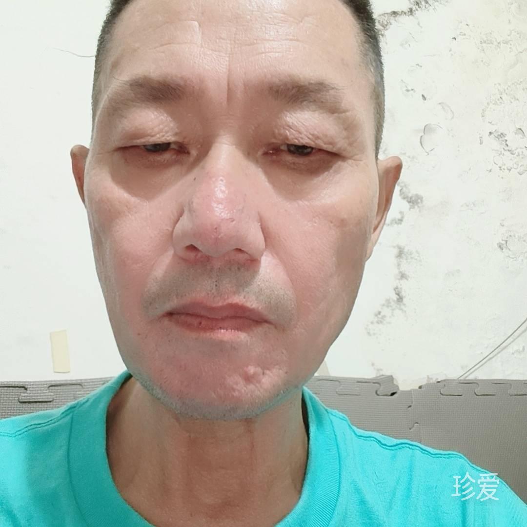 雨吻风