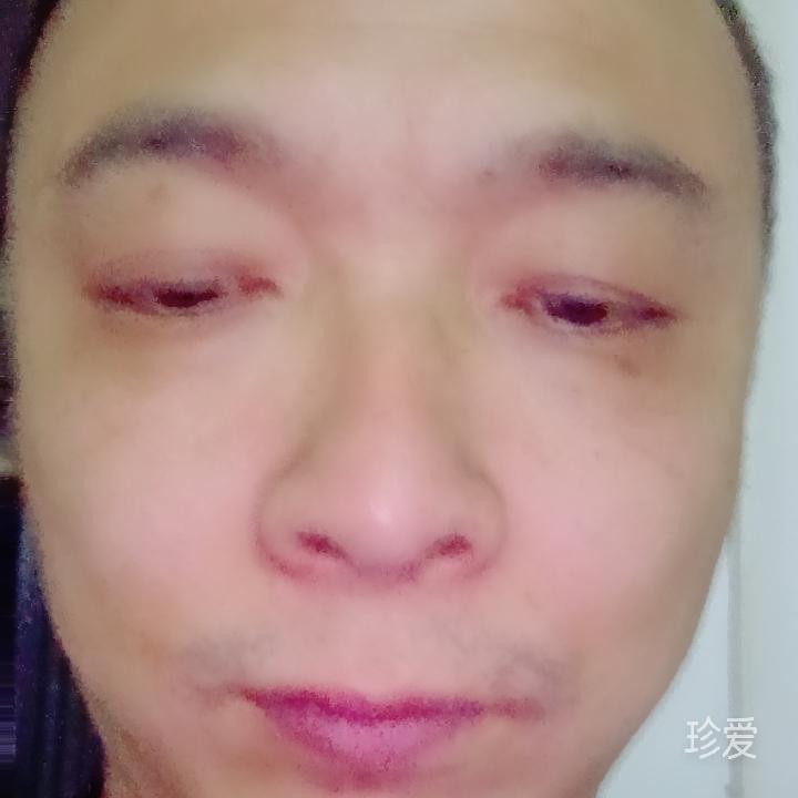 阳光